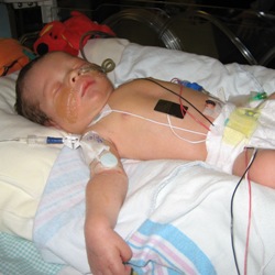 Nicholas was born with blocked intestines. Nicholas was born with blocked intestines.